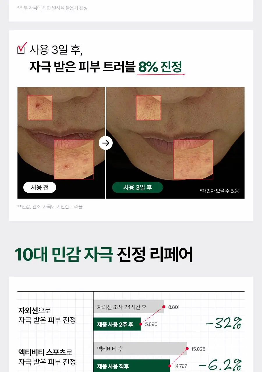 [튜브타입/단독기획] 닥터지 레드 블레미쉬 클리어 수딩크림 EX 70ml 튜브 기획 (+30ml+세럼10ml*2ea) 상세페이지 26